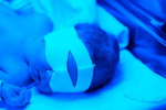Novorodenecká žltačka: Čo môže pomôcť?