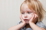 Sedem detských infekčných chorôb - viete ich rozlíšiť podľa prejavu na koži?