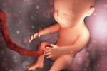 Konizácia krčka maternice: Tehotenstvo po zákroku