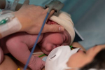 Gynekológ Peter Kaščák: Dnes v našej nemocnici porodila už 15. pozitívne testovaná rodička