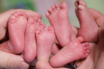 Dvojičky či trojičky? Gynekológ odhaľuje zaujímavé fakty o viacplodovom tehotenstve