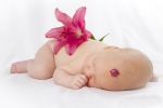Hemangióm - červený fľak na telíčku novorodenca