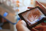 Dobrá vec sa podarila: Predčasniatka môžu rodičia sledovať v inkubátoroch online kamerami