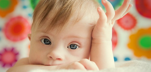 Pri Downovom syndróme má dieťa o jeden chormozóm naviac, teda ich má 47. Aj nadbytočný 21. chormozóm, dieťa sa rodí ako Downov syndróm.