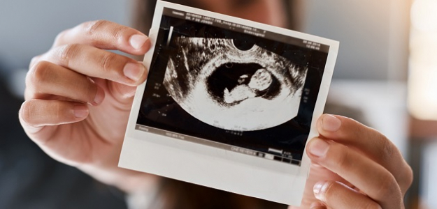 BABY KINO naživo: Koľko ultrazvukov stačí a načo sú 3D a 4D?