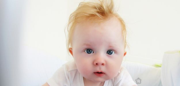Pediatrička radí: Trápi nás mliečna chrasta