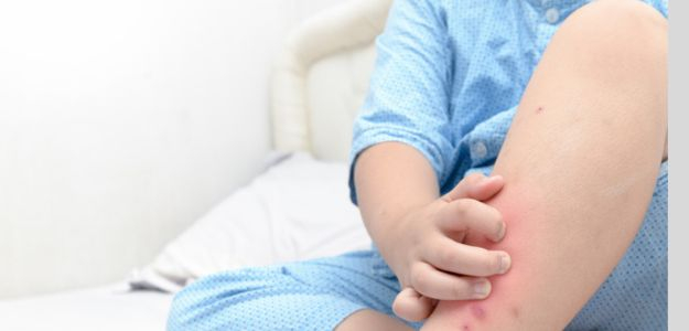 Pediatrička radí: Čo robiť, keď sa dieťa nervózne škriabe?