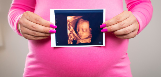 sono, ultrazvuk, 3D, 4D, bábätko v brušku, tehotenstvo