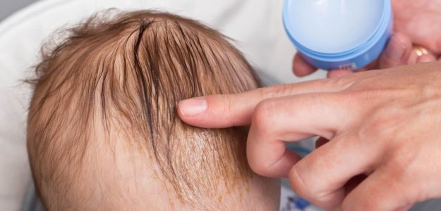 Pediatrička radí: Trápi nás mliečna chrasta